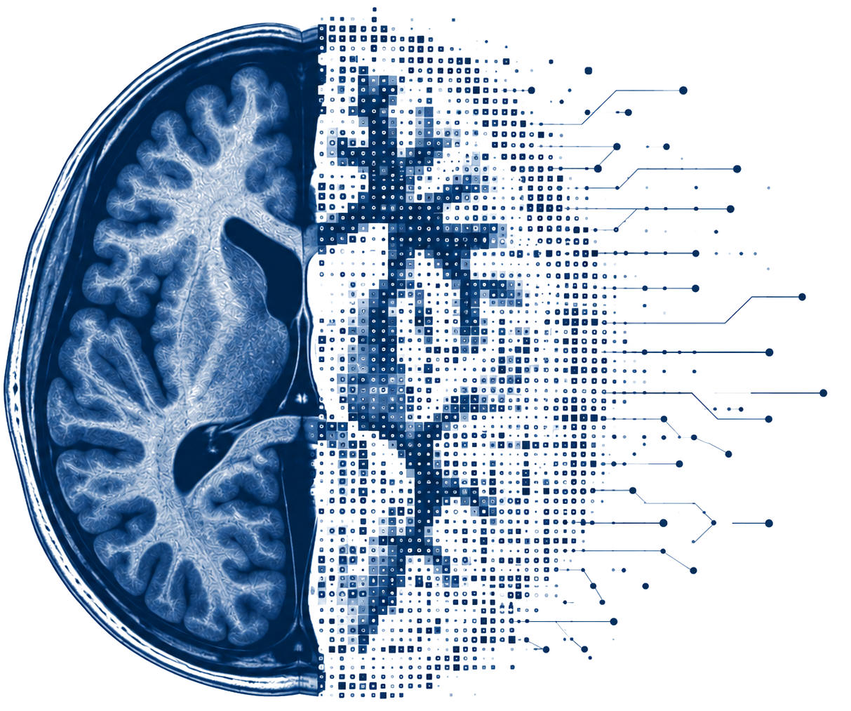 AI-mapped brain scan